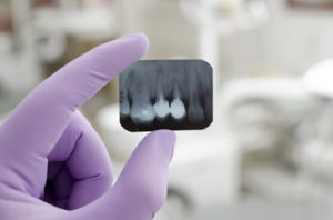 dental xray