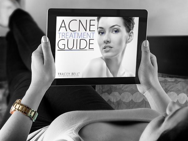 acne guide preview