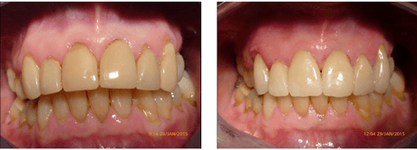 digital-dentisry-douglas-isleofman-best-dental-traceybell