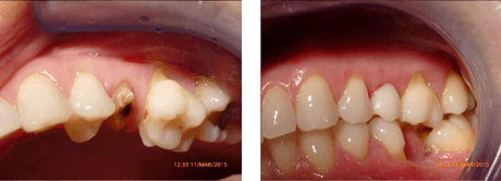 digital-dentistry-best-traceybell-digital-smile-design