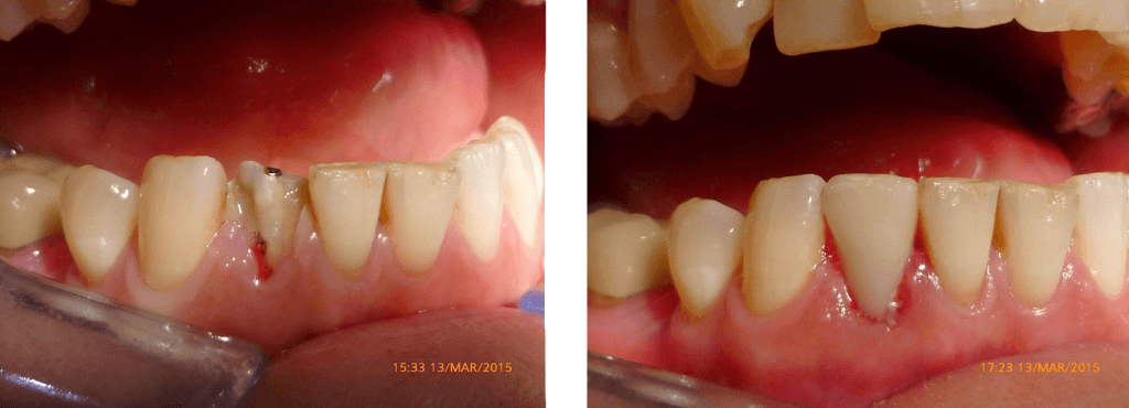 digital-dentistry-liverpool-traceybell