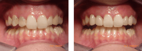 digital-dentistry-uk-traceybel-dental-and-aesthetic-medical-clinicl
